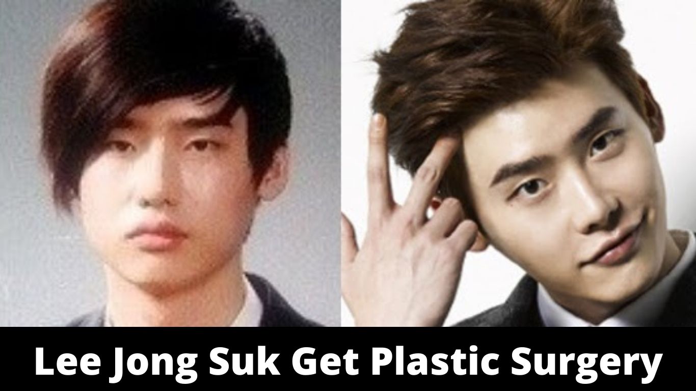Lee Jong Suk Get Plastic Surgery