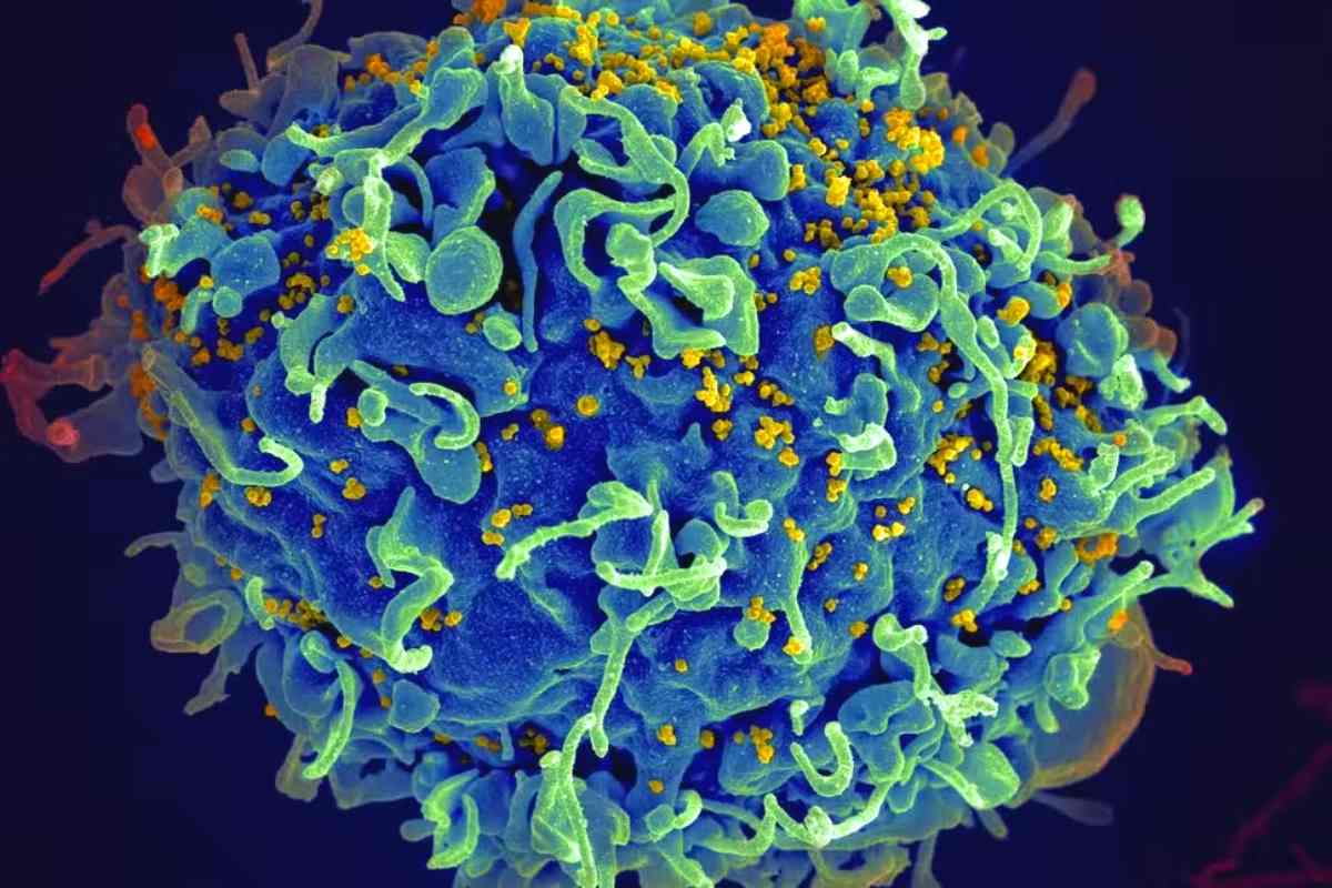 The HIV Infection
