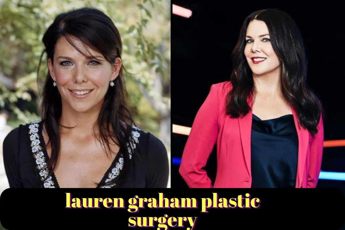 lauren graham plastic surgery