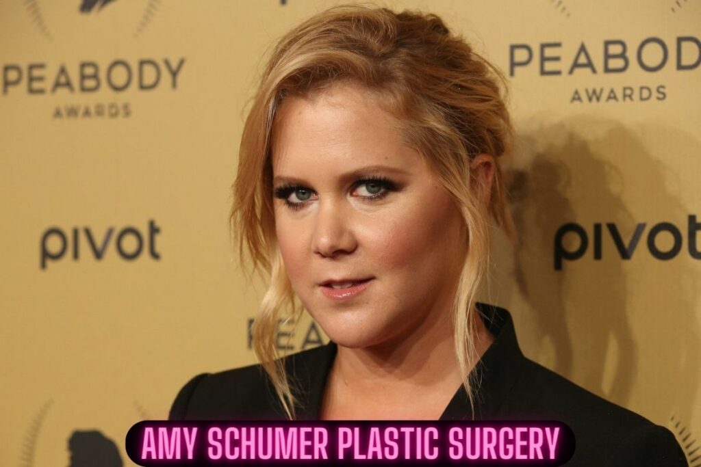 amy schumer plastic surgery