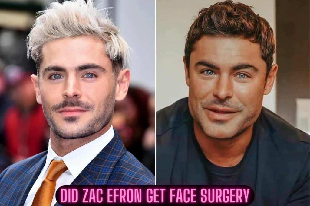 did zac efron get face surgery