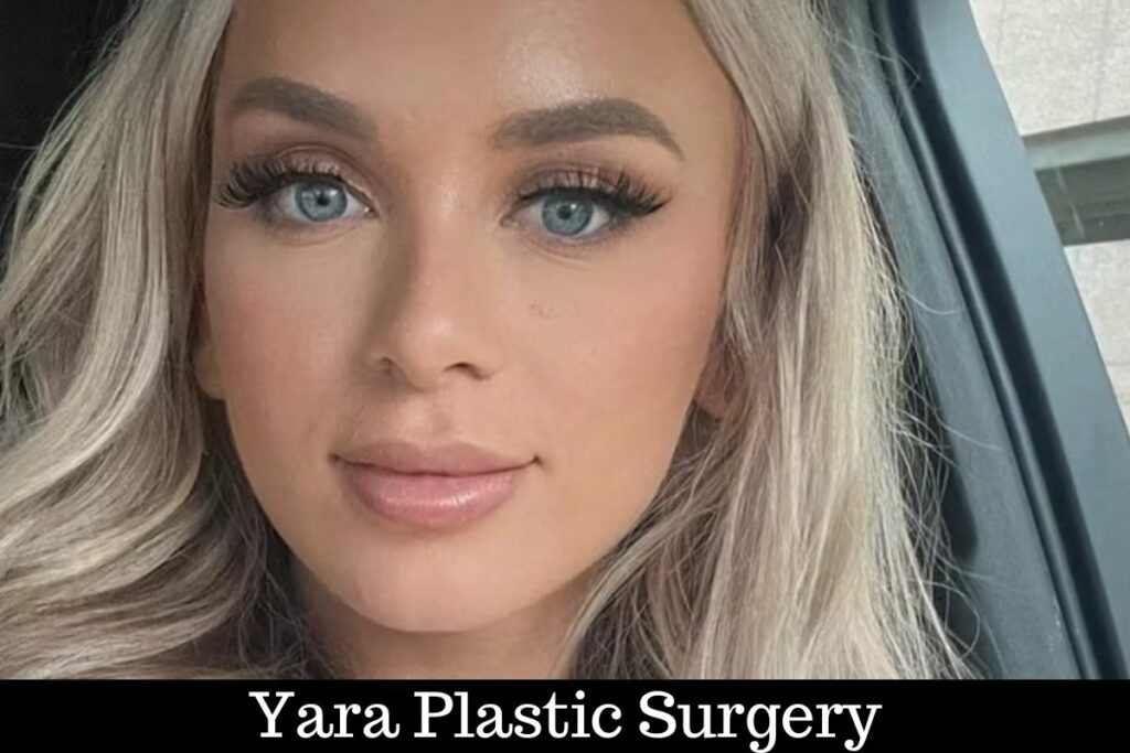 yara plastic surgery