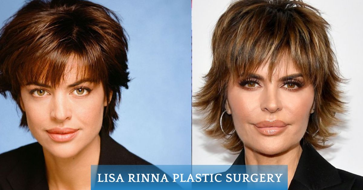 lisa rinna plastic surgery