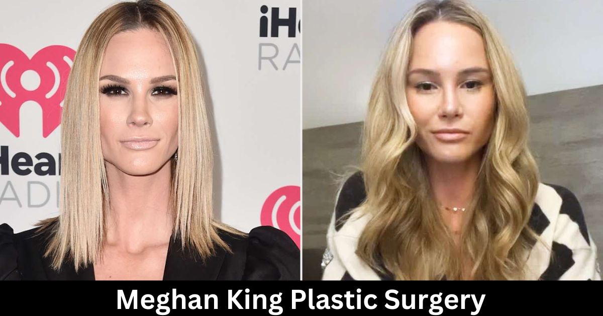 Meghan King Plastic Surgery: She Shows Off Her Changed Breasts And Nose