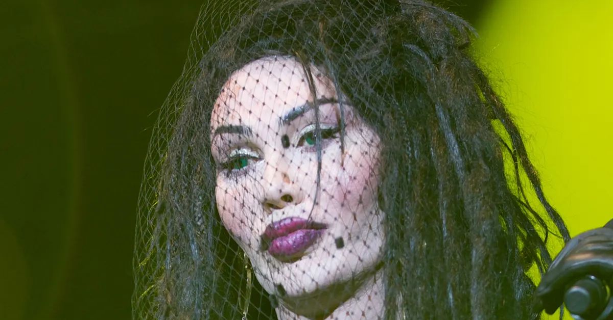 Pete Burns's Plastic Surgery: "Right Round" Singer's Own Words