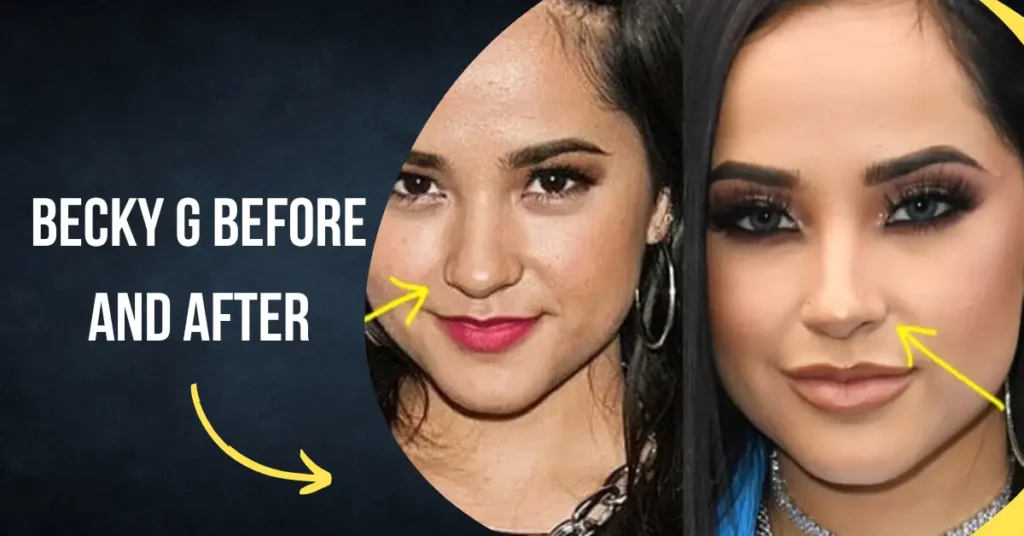 Becky G Before and After