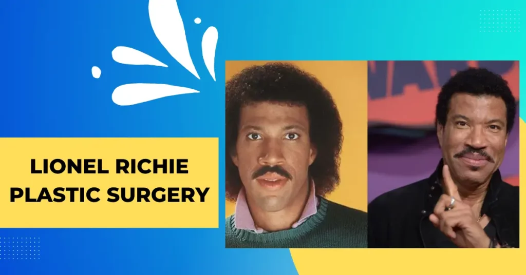 Lionel Richie Plastic Surgery