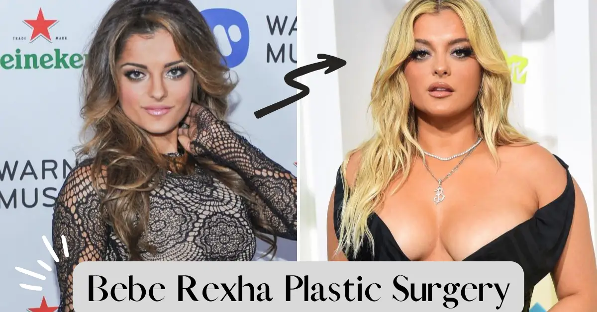 Bebe Rexha Plastic Surgery