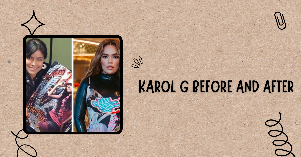 Karol G Before and After
