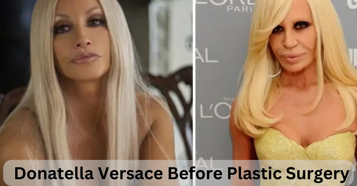 Donatella Versace Before Plastic Surgery The Shocking Truth About Versace S Dramatic Appearance