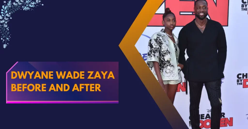 Dwyane Wade Zaya Before and After