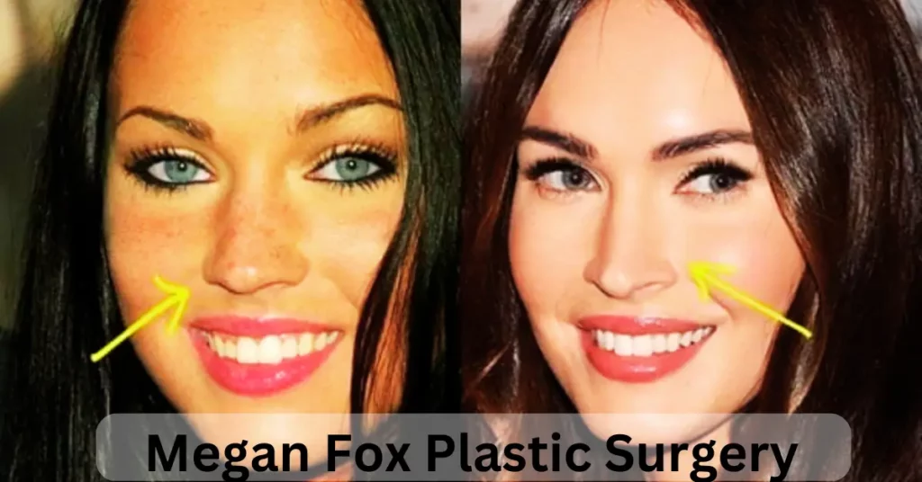 Megan Fox Plastic Surgery