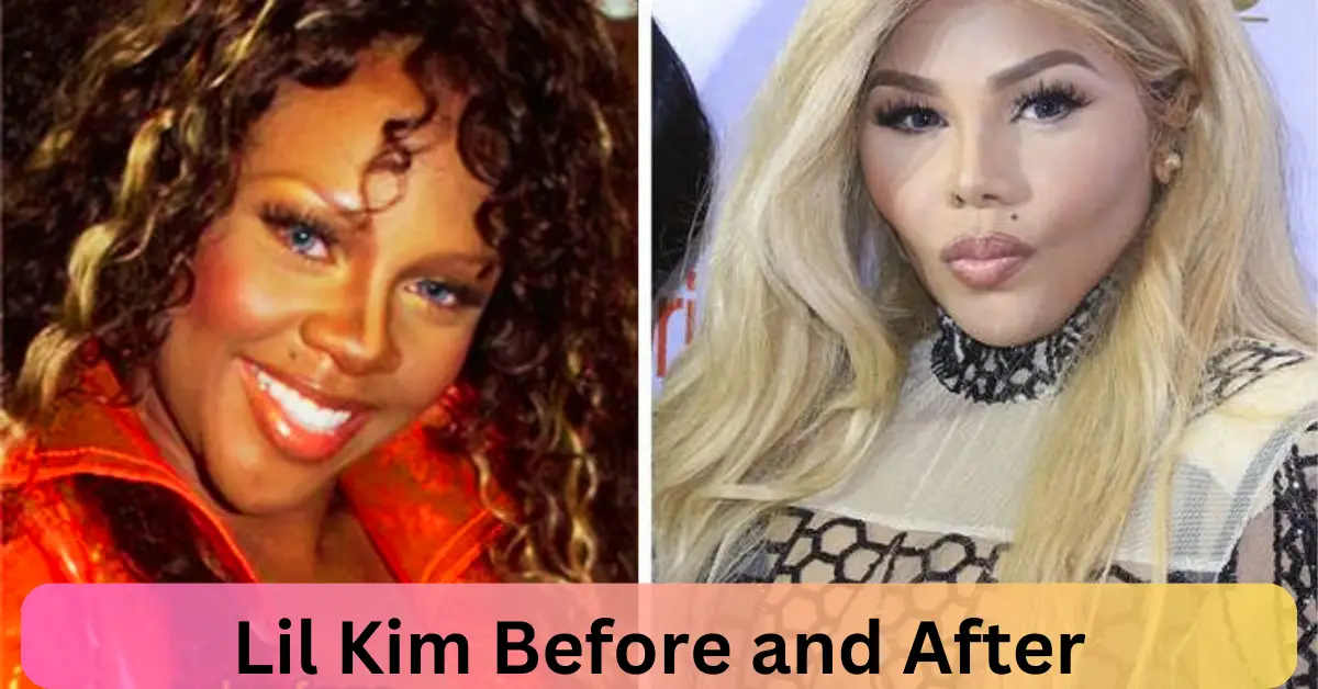 Lil Kim Before and After