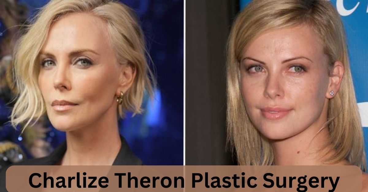Charlize Theron Plastic Surgery