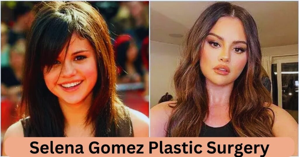 Selena Gomez Plastic Surgery