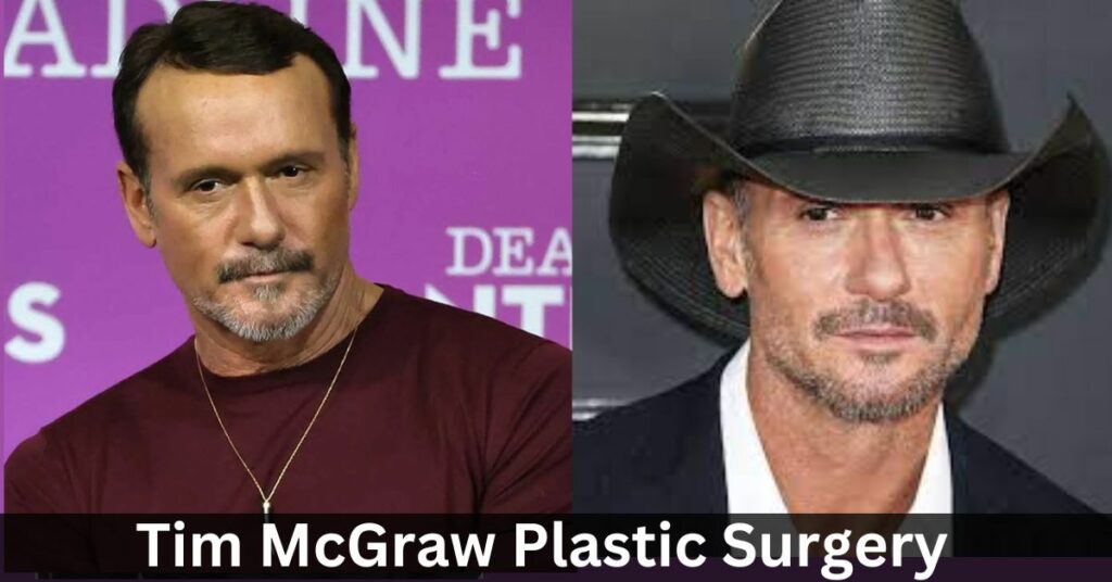 Tim McGraw Plastic Surgery