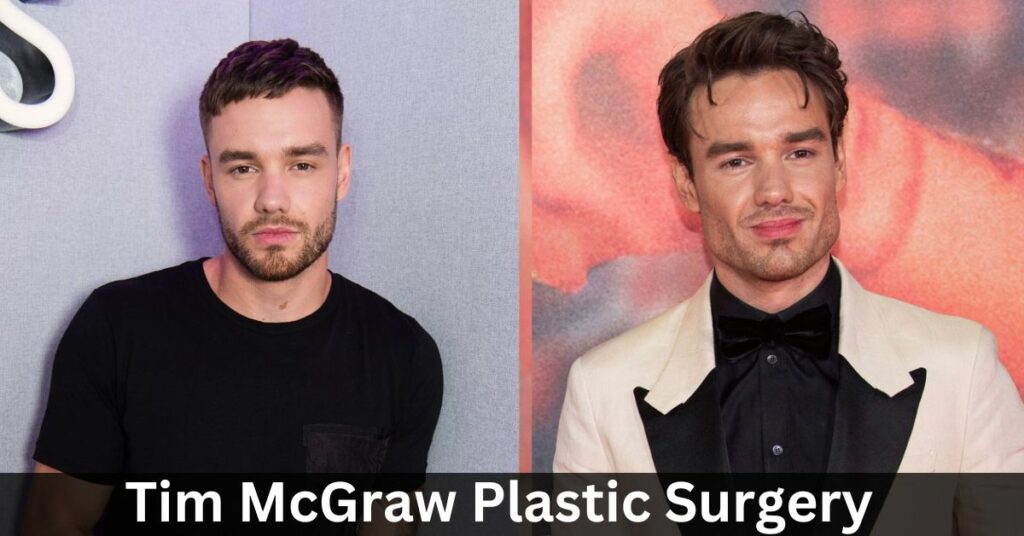 Liam Payne Surgery