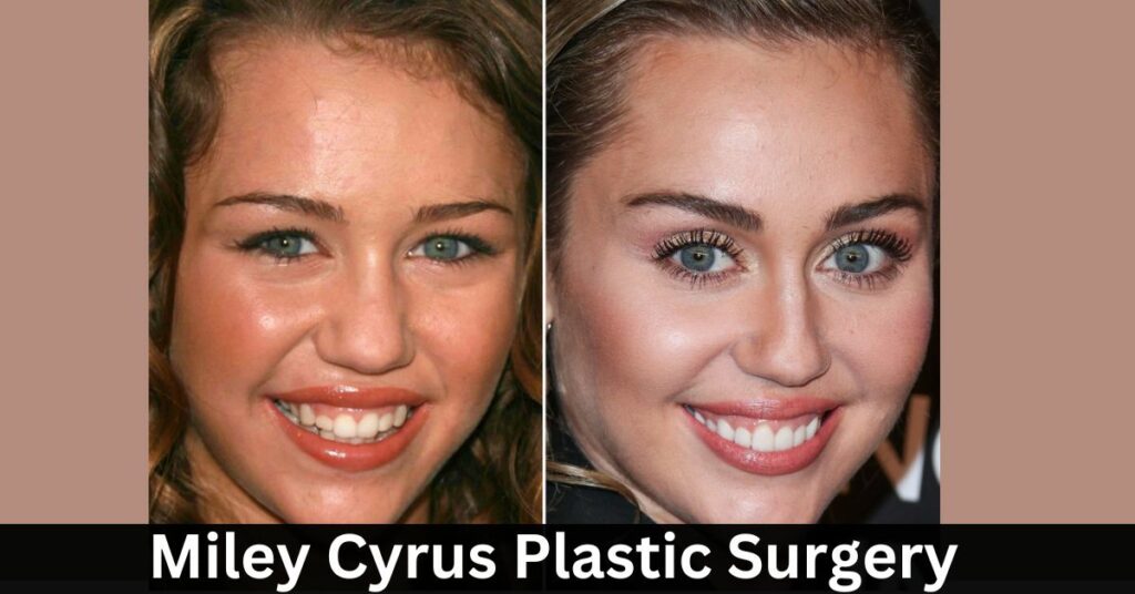 Miley Cyrus Plastic Surgery