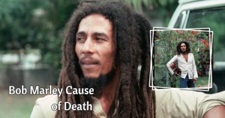 Bob Marley Cause of Death