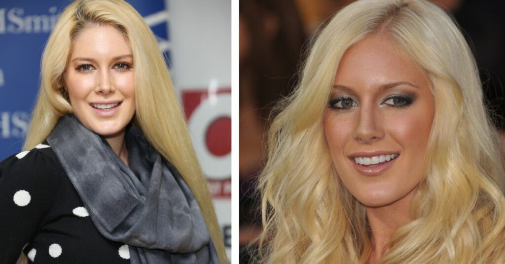 Heidi Montag Before And After Surgery The Truth Behind Her Beautiful Looks 3755